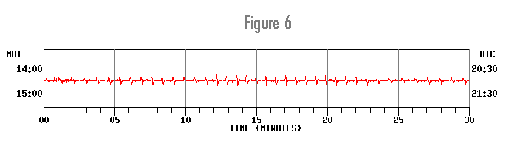 Seismogram-6